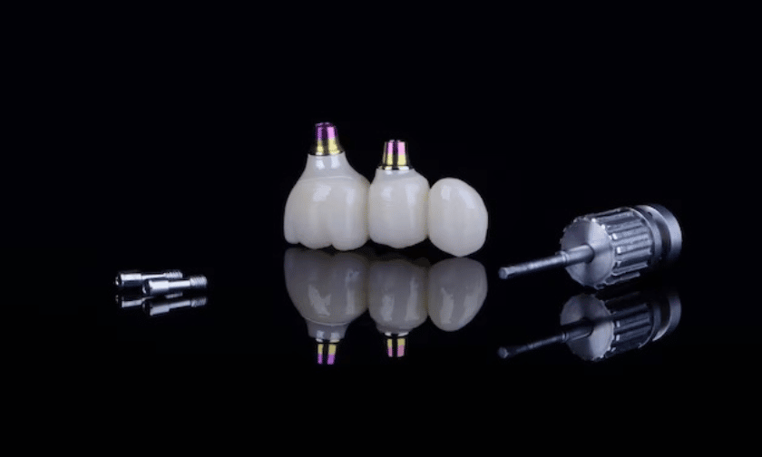 Dental implant components displayed in progression stages: small metal fixtures, white tooth-colored crowns, and implant pla.
