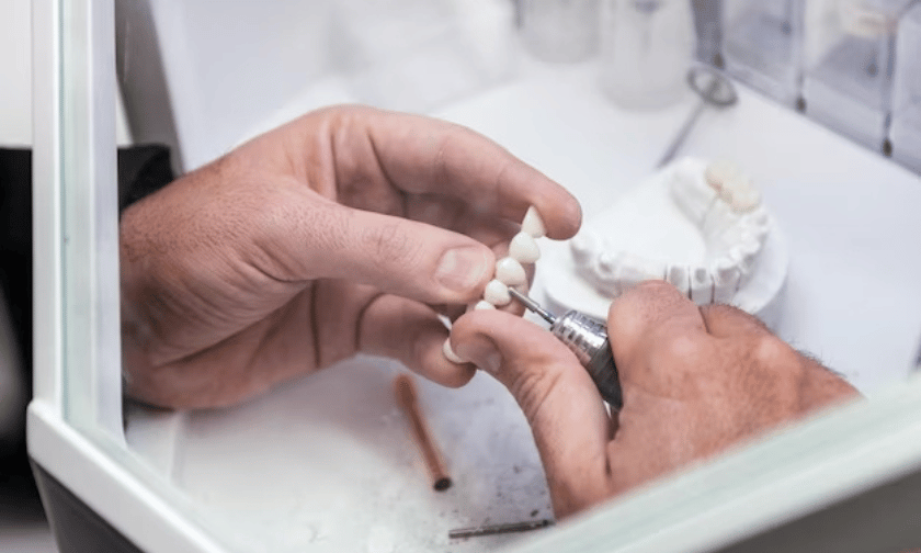 What Types and Materials are Used for Dental Bridges