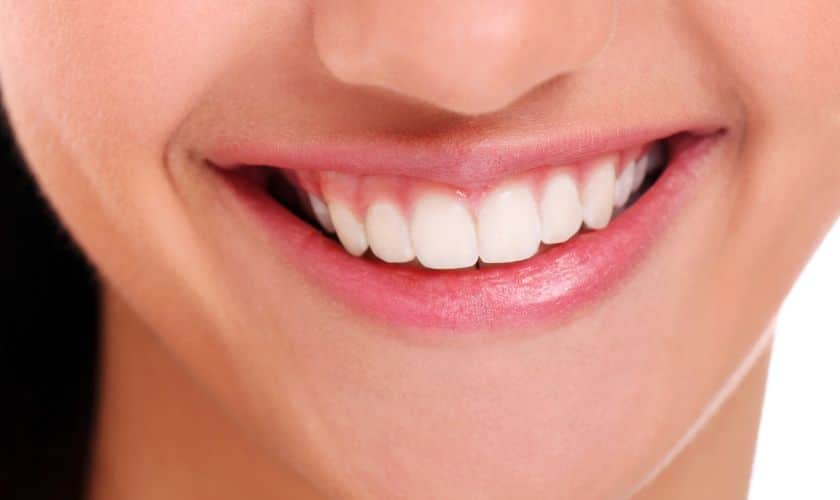 Why Teeth Whitening is Worth It
