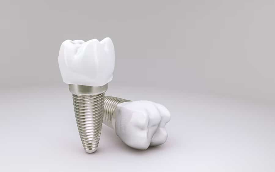 Preventing Fungal Complications After Dental Implants