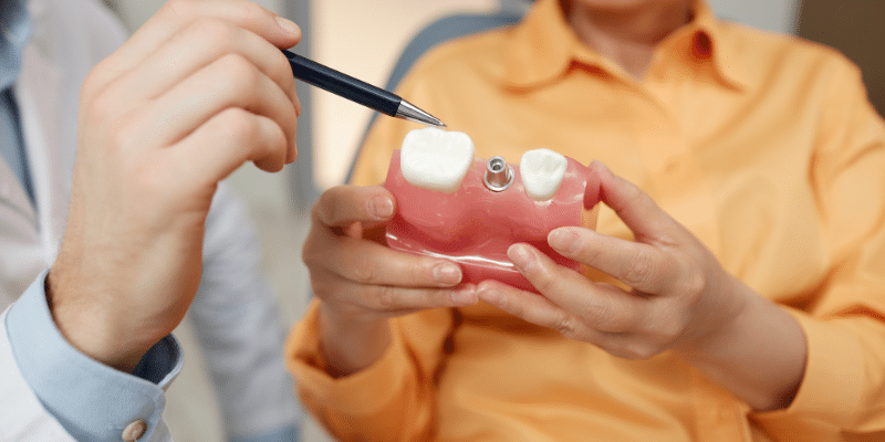 Dental Implants vs Full Dentures