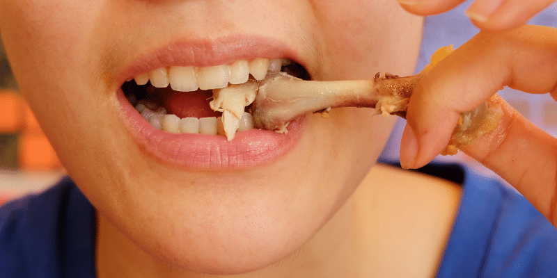 Food Gets Trapped Between Your Teeth