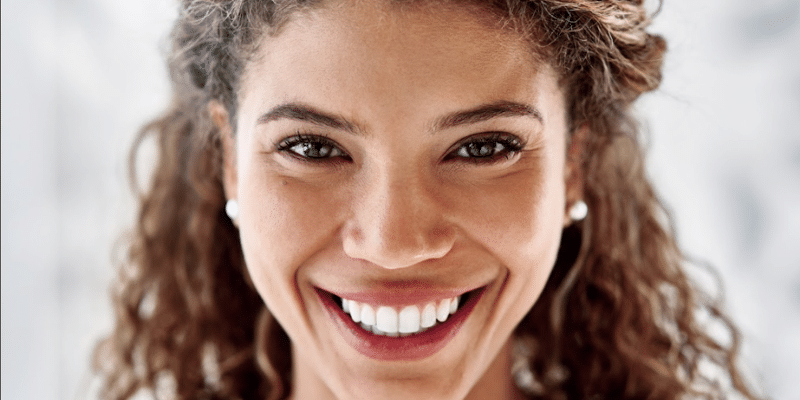 How to Prepare Your Teeth Before the Big Day